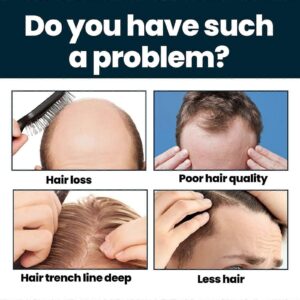 Original Minoxidil Hair Regrowth Extra Strength Topical Hair Loss For Men Solution