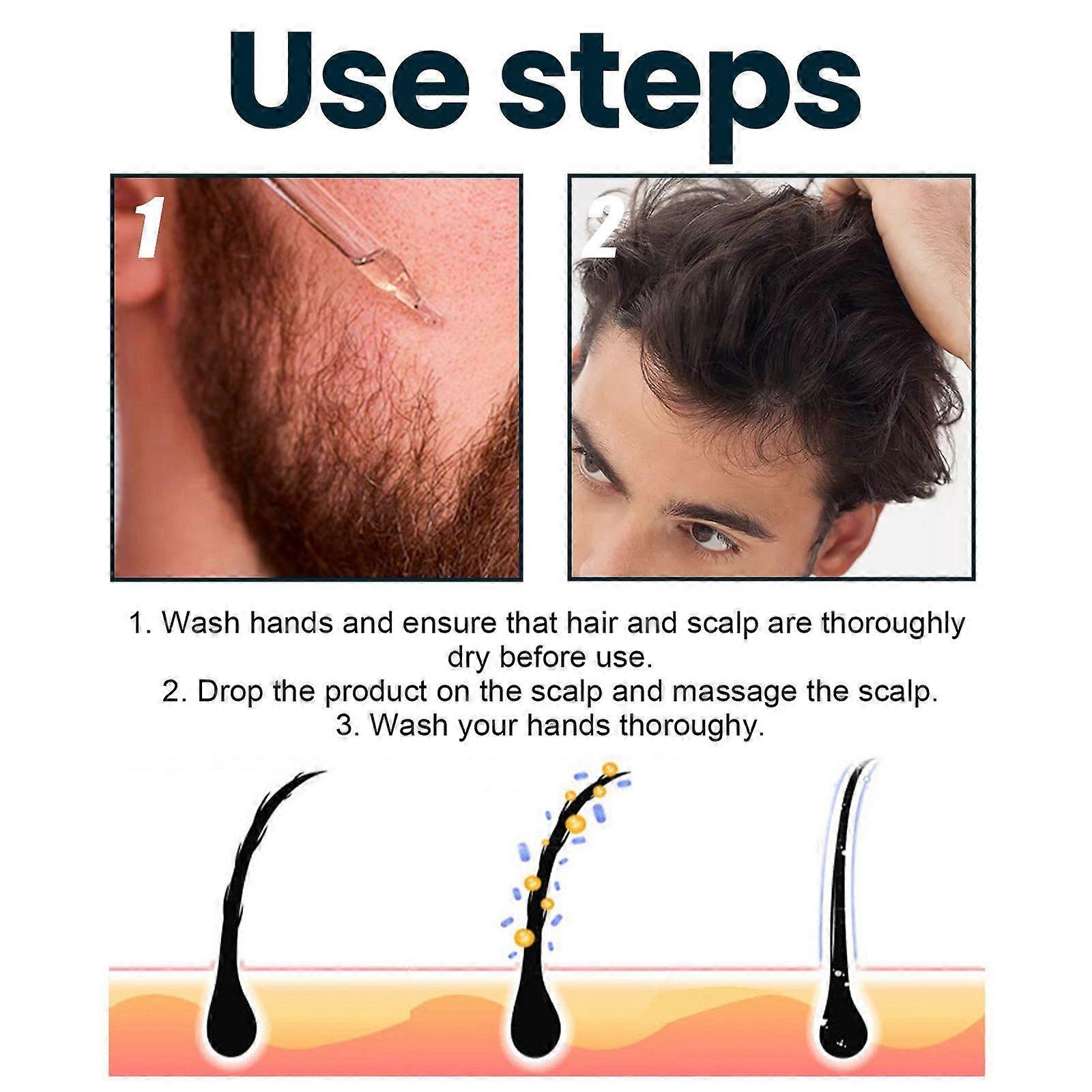 Original Minoxidil Hair Regrowth Extra Strength Topical Hair Loss For Men Solution - Image 5