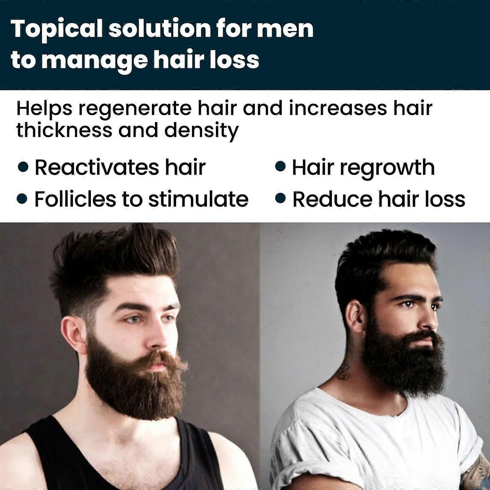 Original Minoxidil Hair Regrowth Extra Strength Topical Hair Loss For Men Solution - Image 4